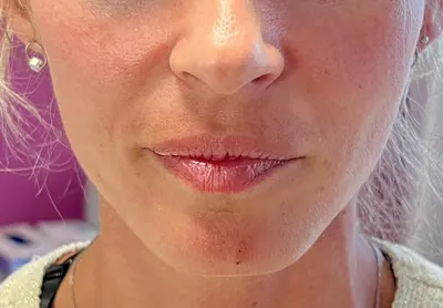 Beauty Derm Kosmetologia Estetyczna